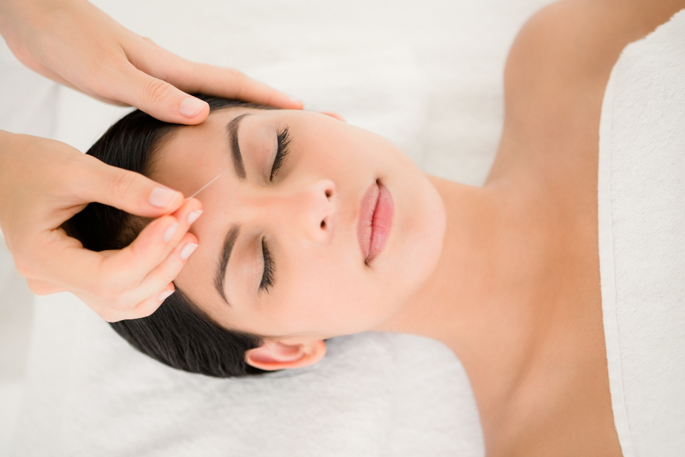 woman-in-an-acupuncture-therapy.jpg