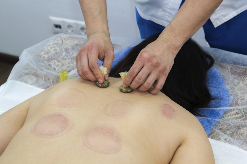 a-woman-taking-a-treatment-of-alternative-medicine-moxo-therapy-procedure.jpg